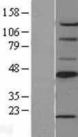 SCD1 (SCD) Human Over-expression Lysate
