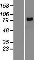 MMP9 Human Over-expression Lysate