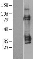 MAGE 1 (MAGEA1) Human Over-expression Lysate