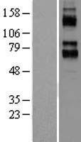 KCNC4 Human Over-expression Lysate