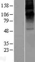 GABRE Human Over-expression Lysate