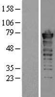 FUS Human Over-expression Lysate