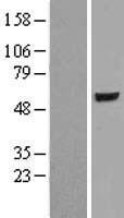 ER81 (ETV1) Human Over-expression Lysate
