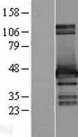 HOMER2 Human Over-expression Lysate