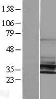 KCNK6 Human Over-expression Lysate