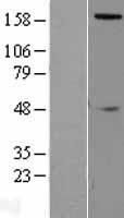 SLIT2 Human Over-expression Lysate