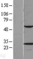 VAPB Human Over-expression Lysate