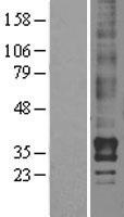 EDG4 (LPAR2) Human Over-expression Lysate
