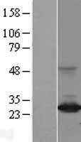 ARHI (DIRAS3) Human Over-expression Lysate