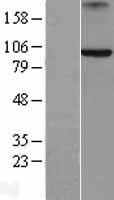 Axin 2 (AXIN2) Human Over-expression Lysate