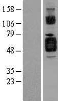 IL1 Receptor II (IL1R2) Human Over-expression Lysate