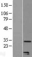 Macrophage Inflammatory Protein 3 alpha (CCL20) Human Over-expression Lysate