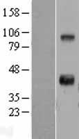 WNT11 Human Over-expression Lysate