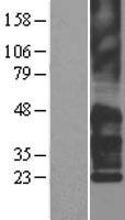 TM4SF2 (TSPAN7) Human Over-expression Lysate