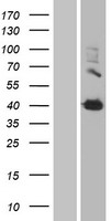 Transglutaminase 2 (TGM2) Human Over-expression Lysate