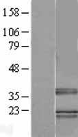 TRA2B Human Over-expression Lysate