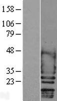 SCN2B Human Over-expression Lysate