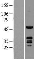 PKNOX1 Human Over-expression Lysate