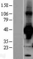 Rad9 (RAD9A) Human Over-expression Lysate