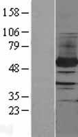 PFKFB4 Human Over-expression Lysate