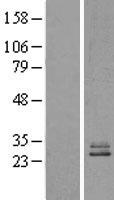 NDUFS3 Human Over-expression Lysate