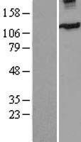 Eg5 (KIF11) Human Over-expression Lysate