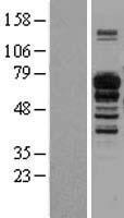 IL16 Human Over-expression Lysate