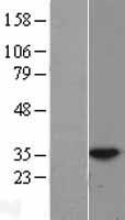 HUS1 Human Over-expression Lysate