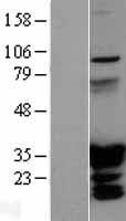 HOXC6 Human Over-expression Lysate