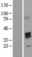 FUT7 Human Over-expression Lysate
