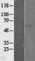 ETV5 Human Over-expression Lysate