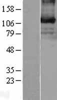 Eph receptor B3 (EPHB3) Human Over-expression Lysate