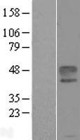 Ephrin B1 (EFNB1) Human Over-expression Lysate