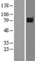DVL1 Human Over-expression Lysate