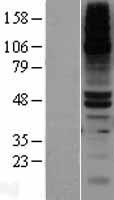 DPEP1 Human Over-expression Lysate