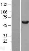 DDX6 Human Over-expression Lysate