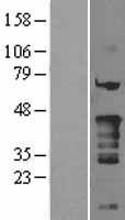 Nkx2.5 (NKX2-5) Human Over-expression Lysate