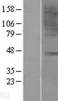CCR6 Human Over-expression Lysate