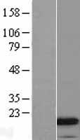 Cathelicidin (CAMP) Human Over-expression Lysate