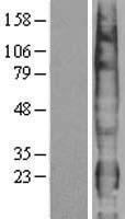 PTTG1IP Human Over-expression Lysate