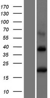 BST2 Human Over-expression Lysate