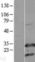 RhoGDI (ARHGDIA) Human Over-expression Lysate