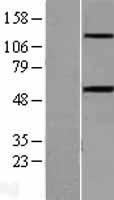 Activin A Receptor Type IB (ACVR1B) Human Over-expression Lysate