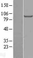 H6PD Human Over-expression Lysate