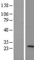 trfp (MED20) Human Over-expression Lysate