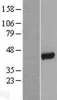 EBP50 (SLC9A3R1) Human Over-expression Lysate