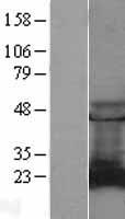 Rab9 (RAB9A) Human Over-expression Lysate