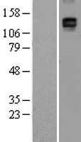 CD163 Human Over-expression Lysate