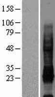 IL32 Human Over-expression Lysate