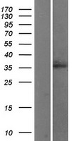 WNT2B Human Over-expression Lysate